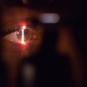 close up of light shining on eyeball- Photorefractive Keratectomy laser eye treatment