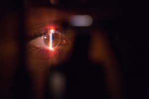 close up of light shining on eyeball- Photorefractive Keratectomy laser eye treatment