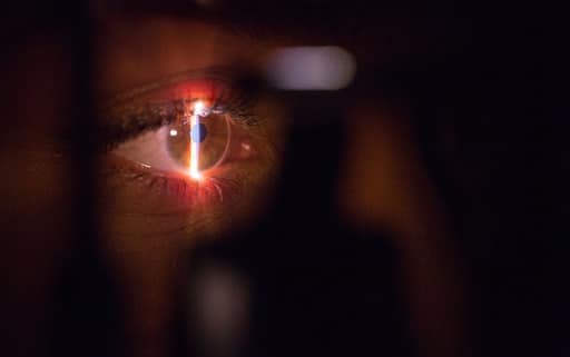 close up of light shining on eyeball- Photorefractive Keratectomy laser eye treatment