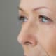 Close up of a older woman in need of Xeomin to tighten the skin around her eyes