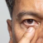 Close up of an elderly man touching his eye after experiencing blepharospasm, or excessive eye twitching.