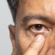 Close up of an elderly man touching his eye after experiencing blepharospasm, or excessive eye twitching.